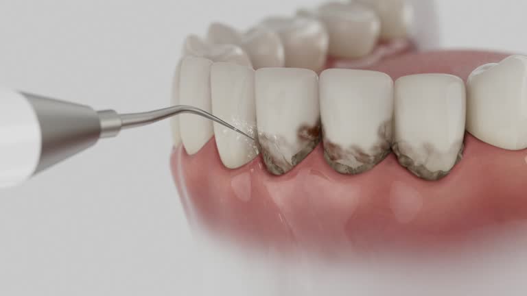 Reliable Dental Implants contractor in Mullins, SC by Smile Center Dentistry